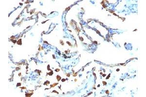 Immunohistochemistry (Formalin-fixed Paraffin-embedded Sections) (IHC (fp)) image for anti-Milk Fat Globule-EGF Factor 8 Protein (MFGE8) antibody (ABIN3025866)
