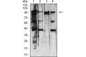 Western blot analysis using PMS2 mouse mAb against Hela (1), A431 (2), Jurkat (3), and A549 (4) cell lysate.