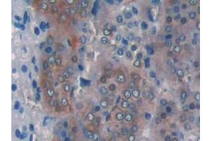 DAB staining on IHC-P; Samples: Rat Adrenal gland Tissue (CPT1A 抗体  (AA 572-773))