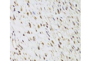 Immunohistochemistry of paraffin-embedded Human leiomyoma of uterus using SEPHS1 Polyclonal Antibody at dilution of 1:100 (40x lens). (SEPHS1 抗体)