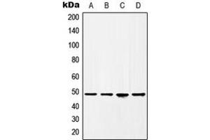 Western blot analysis of HAT1 expression in HeLa (A), BT20 (B), A431 (C), HEK293T (D) whole cell lysates. (HAT1 抗体  (C-Term))
