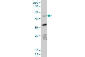 Western Blotting (WB) image for anti-Deleted in Azoospermia 1 (DAZ1) (AA 21-121) antibody (ABIN598639) (DAZ1 抗体  (AA 21-121))