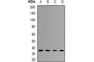 Western blot analysis of UCH-L5 expression in HT29 (A), Hela (B), mouse liver (C), rat brain (D) whole cell lysates.