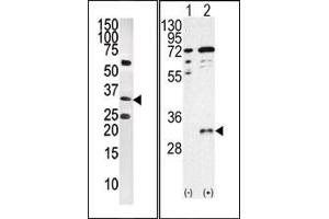 Image no. 1 for anti-CTD (Carboxy-terminal Domain, RNA Polymerase II, Polypeptide A) Small Phosphatase 1 (CTDSP1) (AA 1-250), (C-Term), (N-Term) antibody (ABIN360805) (CTDSP1 抗体  (C-Term, N-Term))