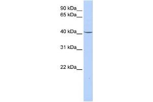 Western Blotting (WB) image for anti-Glycerol-3-Phosphate Dehydrogenase 1 (Soluble) (GPD1) antibody (ABIN2458632) (GPD1 抗体)