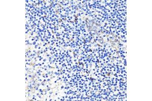 Immunohistochemistry (Paraffin-embedded Sections) (IHC (p)) image for anti-Yes-Associated Protein 1 (YAP1) antibody (ABIN1683302)