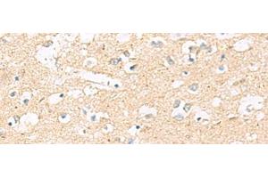 Immunohistochemistry of paraffin-embedded Human brain tissue using MRPL20 Polyclonal Antibody at dilution of 1:60(x200) (MRPL20 抗体)