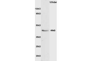 Rat liver lysate probed with Anti VASH1 Polyclonal Antibody, Unconjugated  at 1:3000 for 90 min at 37˚C. (VASH1 抗体  (AA 281-365))