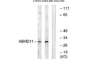 Western blot analysis of extracts from HUVEC cells and COLO cells, using ABHD11 antibody. (ABHD11 抗体)