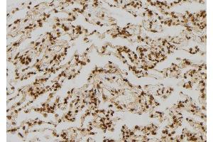 ABIN6277324 at 1/100 staining Human lung tissue by IHC-P. (FABP7 抗体  (C-Term))