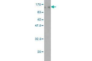 Western Blotting (WB) image for anti-Topoisomerase (DNA) III beta (TOP3B) (AA 1-862) antibody (ABIN563888)