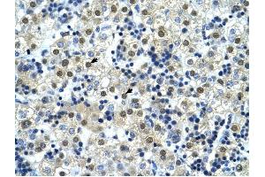 NFYC antibody was used for immunohistochemistry at a concentration of 4-8 ug/ml to stain Hepatocytes (arrows) in Human Liver.
