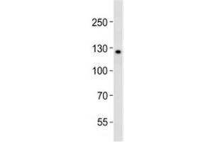 Western blot analysis of lysate from K562 cell line using LIFR antibody diluted at 1:1000. (LIFR 抗体  (C-Term))
