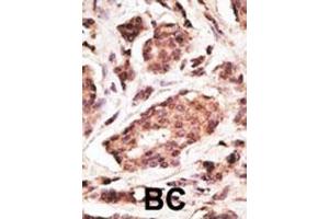 Immunohistochemistry (Paraffin-embedded Sections) (IHC (p)) image for anti-Ubiquitin Carboxyl-terminal Esterase L1 (Ubiquitin Thiolesterase) (UCHL1) (AA 187-216), (C-Term) antibody (ABIN1882188)