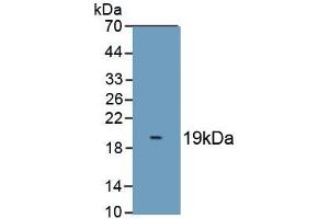 Detection of Recombinant S100A8, Cattle using Polyclonal Antibody to S100 Calcium Binding Protein A8 (S100A8) (S100A8 抗体  (AA 1-89))