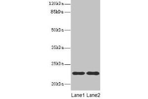 Western blot All lanes: ASF1B antibody at 13 μg/mL Lane 1: MCF-7 whole cell lysate Lane 2: Jurkat whole cell lysate Secondary Goat polyclonal to rabbit IgG at 1/10000 dilution Predicted band size: 23 kDa Observed band size: 23 kDa (ASF1B 抗体  (AA 1-202))