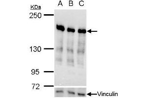 WB Image Ribosome binding protein 1 antibody validation by siRNA knock-down. (RRBP1 抗体  (C-Term))