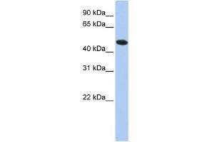 WB Suggested Anti-TXNDC5 Antibody Titration: 0. (TXNDC5 抗体  (N-Term))