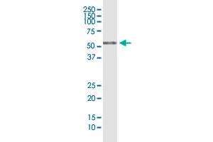 Western Blotting (WB) image for anti-RRIO Kinase 3 (RIOK3) (AA 1-516) antibody (ABIN563783)
