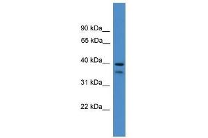 SERPINB6 antibody used at 0. (SERPINB6 抗体  (Middle Region))