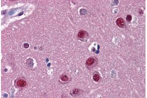 anti-Nuclear Receptor Subfamily 1, Group D, Member 1 (NR1D1) (AA 1-615) antibody