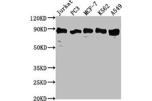 Western Blot Positive WB detected in: Jurkat whole cell lysate, PC3 whole cell lysate, MCF-7 whole cell lysate, K562 whole cell lysate, A549 whole cell lysate All lanes: BRAT1 antibody at 1:2000 Secondary Goat polyclonal to rabbit IgG at 1/50000 dilution Predicted band size: 89, 31, 32 kDa Observed band size: 89 kDa (BAAT1 抗体  (AA 603-821))