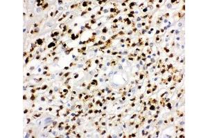 IHC-P: MPO antibody testing of human appendicitis tissue (Myeloperoxidase 抗体  (AA 406-745))