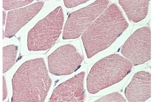 ABIN1782135 (5 μg/mL) staining of paraffin embedded Human Skeletal Muscle. (DVL1 抗体  (AA 20-32))
