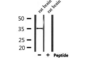 Western blot analysis of extracts from rat brain, using OR2L2 Antibody. (OR2L2 抗体)