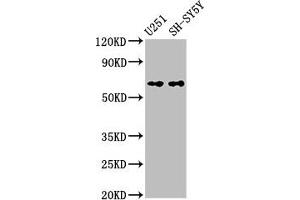Western Blot Positive WB detected in: U251 whole cell lysate, SH-SY5Y whole cell lysate All lanes: Nox4 antibody at 3. (NADPH Oxidase 4 抗体  (AA 210-424))