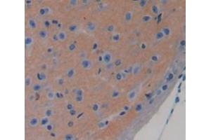 Used in DAB staining on fromalin fixed paraffin- embedded brain tissue (CHRDL1 抗体  (AA 272-447))