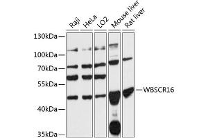 Western blot analysis of extracts of various cell lines, using WBSCR16 antibody (ABIN7271367) at 1:3000 dilution. (WBSCR16 抗体  (AA 1-230))