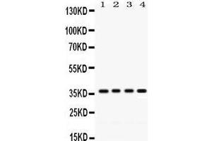 Western Blotting (WB) image for anti-Forkhead Box A3 (FOXA3) (AA 291-324), (C-Term) antibody (ABIN3042401) (FOXA3 抗体  (C-Term))