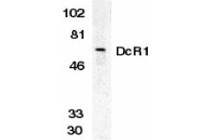Image no. 1 for anti-Tumor Necrosis Factor Receptor Superfamily, Member 10c (TNFRSF10C) (Extracellular Domain) antibody (ABIN203554) (DcR1 抗体  (Extracellular Domain))