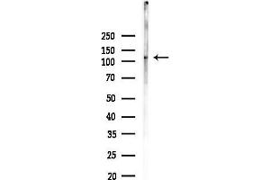 Western blot analysis of lysates from Mouse liver, using GUCY2C Antibody at 1/1000 dilution.