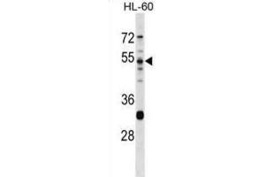 Western Blotting (WB) image for anti-Protease, serine, 16 (Thymus) (PRSS16) antibody (ABIN2998848) (PRSS16 抗体)