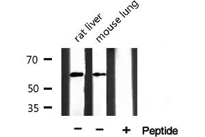 Western blot analysis of extracts of various tissue ,using Keratin 10 antibody. (Keratin 10 抗体  (Internal Region))