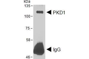 HEK293 lysate overexpressing Human DYKDDDDK-tagged PKD1 was used to immunoprecipitate PKD1 with 2ug Antibody. (PKC mu 抗体  (AA 233-246))