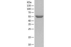 Western Blotting (WB) image for Pyruvate Kinase M2 (PKM2) (AA 1-531) protein (His tag) (ABIN7124724)