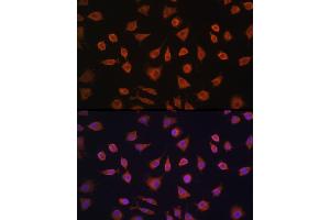 Immunofluorescence analysis of L929 cells using PFKFB2 Rabbit pAb (ABIN6129842, ABIN6145483, ABIN6145484 and ABIN6224971) at dilution of 1:100 (40x lens). (PFKFB2 抗体  (AA 446-505))