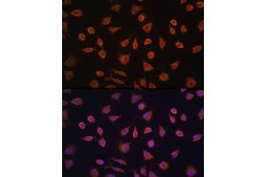 Immunofluorescence analysis of L929 cells using PFKFB2 Rabbit pAb (ABIN6129842, ABIN6145483, ABIN6145484 and ABIN6224971) at dilution of 1:100 (40x lens). (PFKFB2 抗体  (AA 446-505))
