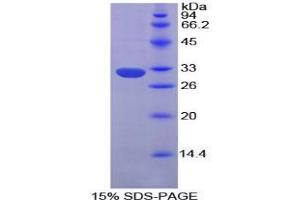 SDS-PAGE analysis of Mouse EPHA1 Protein. (EPHA1 蛋白)
