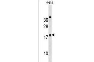 RN Antibody (Center) (ABIN1538629 and ABIN2850418) western blot analysis in Hela cell line lysates (35 μg/lane). (RNF224 抗体  (AA 79-105))