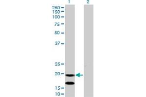 Western Blot analysis of EMP3 expression in transfected 293T cell line by EMP3 monoclonal antibody (M01), clone 3D4. (EMP3 抗体  (AA 1-163))