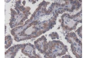 DAB staining on IHC-P; Samples: Human Thyroid Tissue (UXT 抗体  (AA 15-157))