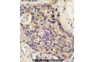 Immunohistochemistry (IHC) image for anti-Hepatocyte Growth Factor (Hepapoietin A, Scatter Factor) (HGF) antibody (ABIN2999319)