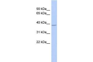 WB Suggested Anti-SOX7 Antibody Titration:  1 ug/ml  Positive Control:  Fetal Stomach cell lysate (SOX7 抗体  (Middle Region))