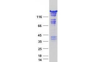 Western Blotting (WB) image for SWI/SNF Related, Matrix Associated, Actin Dependent Regulator of Chromatin, Subfamily C, Member 2 (SMARCC2) (Transcript Variant 2) protein (Myc-DYKDDDDK Tag) (ABIN2732239)