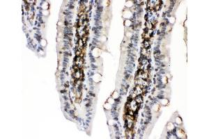 IHC analysis of PKC alpha using anti-PKC alpha antibody (ABIN3043549).