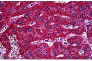 Human Liver: Formalin-Fixed, Paraffin-Embedded (FFPE) (SLC13A5 抗体  (AA 152-207))